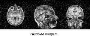 neurologia