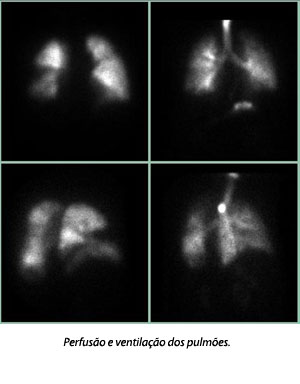 pneumologia